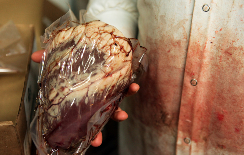 Veal Heart